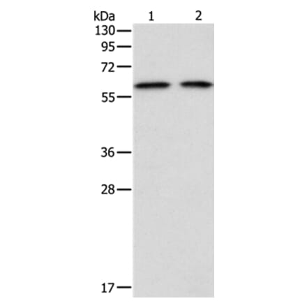 ADAM2 Antibody from Signalway Antibody (36041) - Antibodies.com