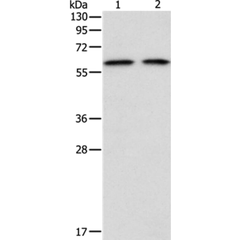 ADAM2 Antibody from Signalway Antibody (36041) - Antibodies.com