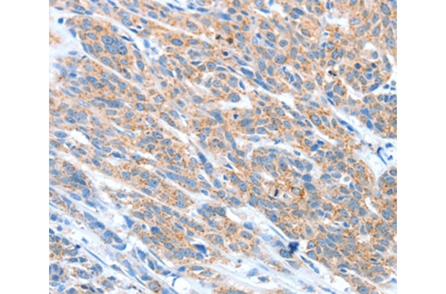 Immunohistochemistry - ADAM2 Antibody from Signalway Antibody (36041) - Antibodies.com