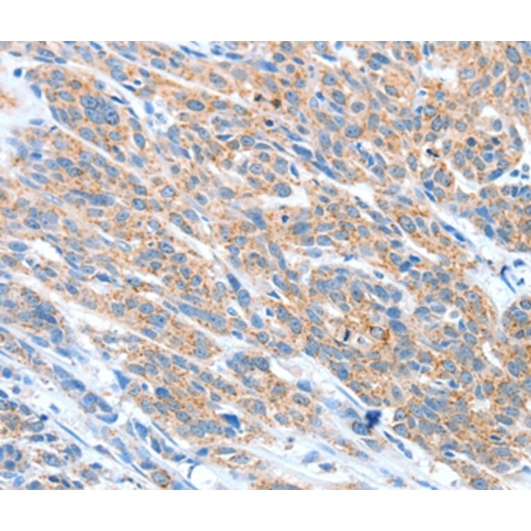 Immunohistochemistry - ADAM2 Antibody from Signalway Antibody (36041) - Antibodies.com
