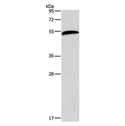 AEBP2 Antibody from Signalway Antibody (36055) - Antibodies.com