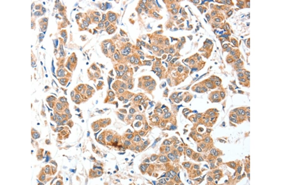 Immunohistochemistry - AEBP2 Antibody from Signalway Antibody (36055) - Antibodies.com