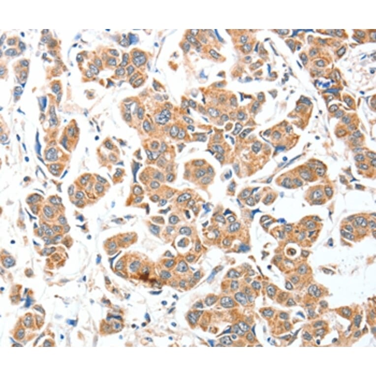 Immunohistochemistry - AEBP2 Antibody from Signalway Antibody (36055) - Antibodies.com