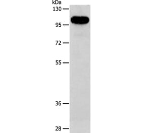 AFAP1 Antibody from Signalway Antibody (36056) - Antibodies.com