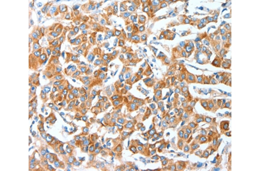 Immunohistochemistry - AFAP1 Antibody from Signalway Antibody (36056) - Antibodies.com