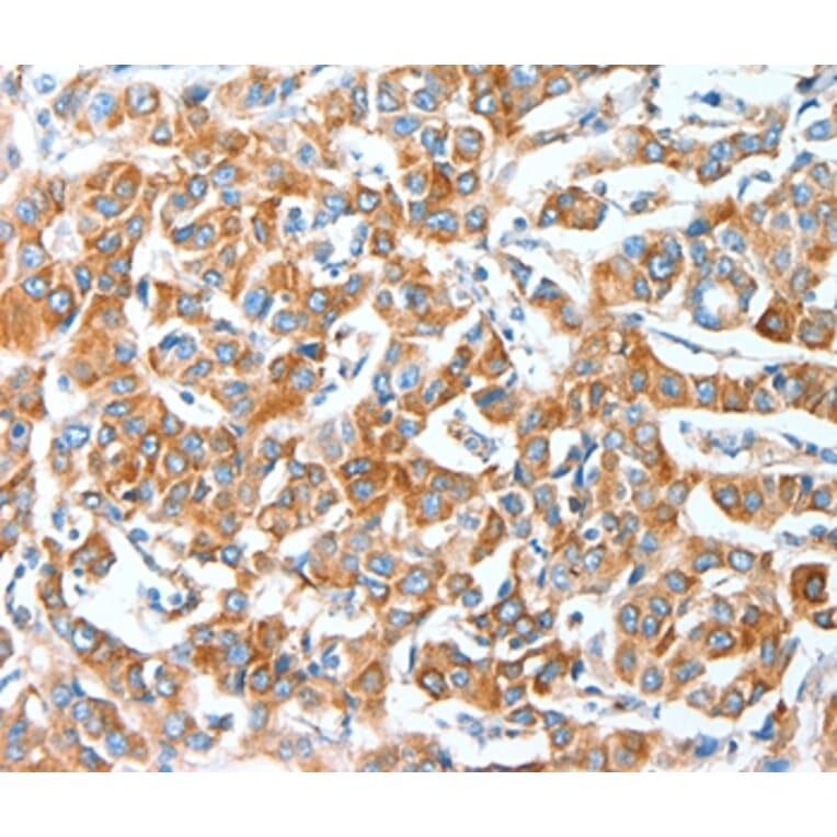 Immunohistochemistry - AFAP1 Antibody from Signalway Antibody (36056) - Antibodies.com