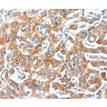 Immunohistochemistry - AFAP1 Antibody from Signalway Antibody (36056) - Antibodies.com