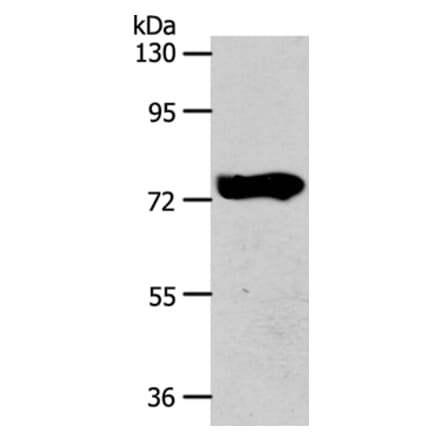 AGBL3 Antibody from Signalway Antibody (36060) - Antibodies.com