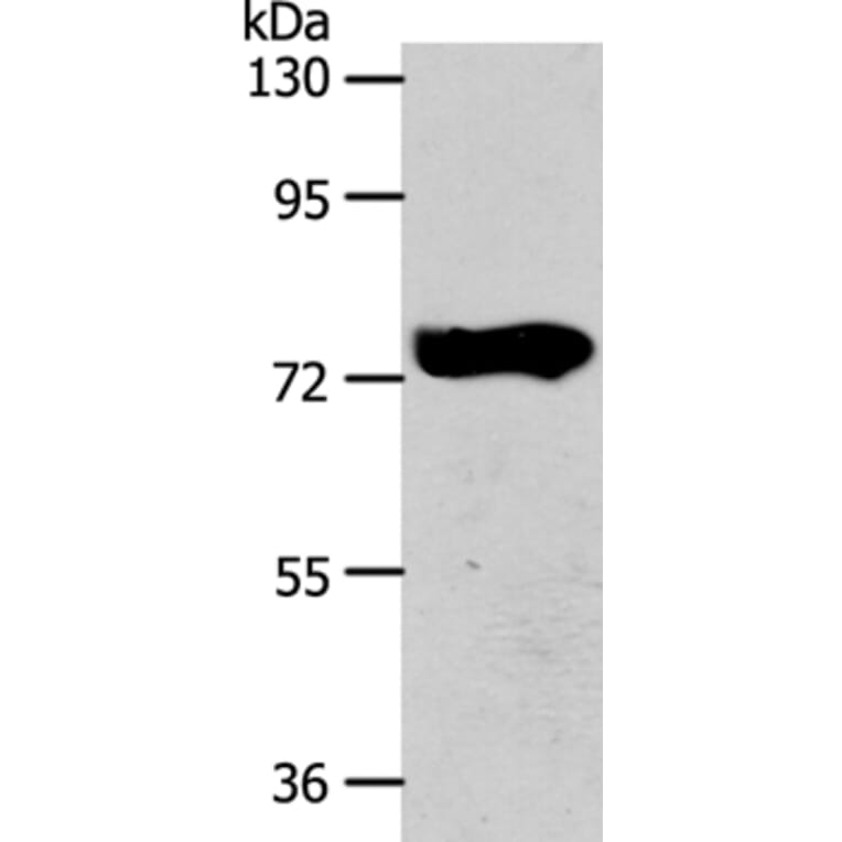 AGBL3 Antibody from Signalway Antibody (36060) - Antibodies.com