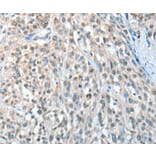 Immunohistochemistry - AGBL3 Antibody from Signalway Antibody (36060) - Antibodies.com