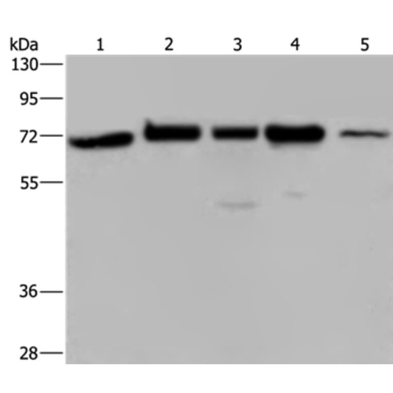 AGFG1 Antibody from Signalway Antibody (36061) - Antibodies.com