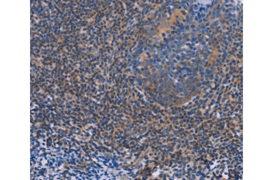 Immunohistochemistry - AGFG1 Antibody from Signalway Antibody (36061) - Antibodies.com