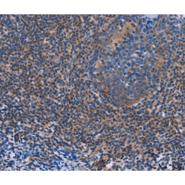 Immunohistochemistry - AGFG1 Antibody from Signalway Antibody (36061) - Antibodies.com
