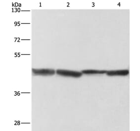 ADH1A Antibody from Signalway Antibody (36075) - Antibodies.com