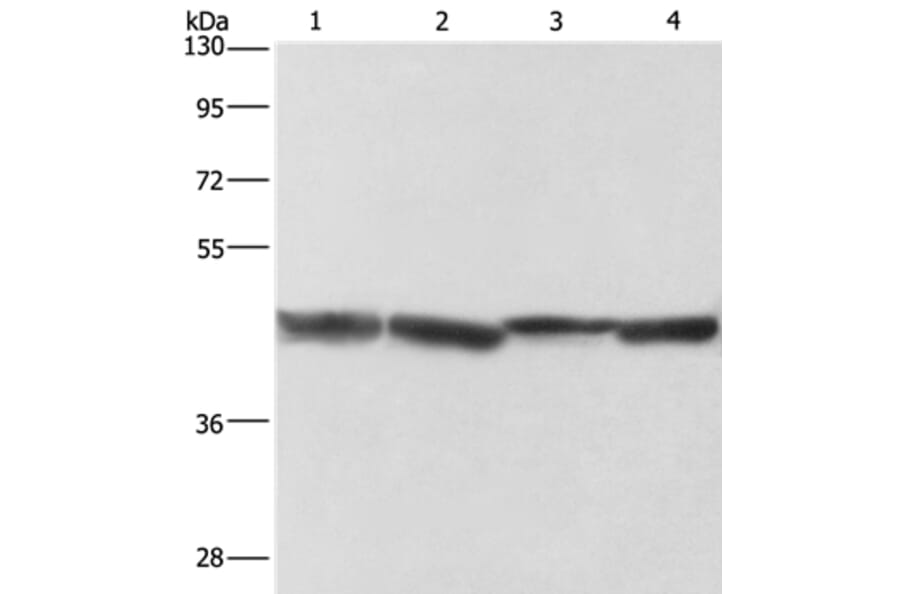 ADH1A Antibody from Signalway Antibody (36075) - Antibodies.com