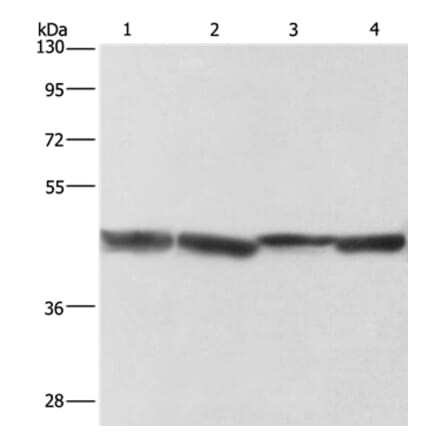 ADH1A Antibody from Signalway Antibody (36075) - Antibodies.com