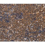 Immunohistochemistry - ADH1A Antibody from Signalway Antibody (36075) - Antibodies.com