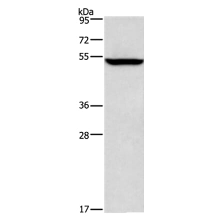 ALG12 Antibody from Signalway Antibody (36079) - Antibodies.com