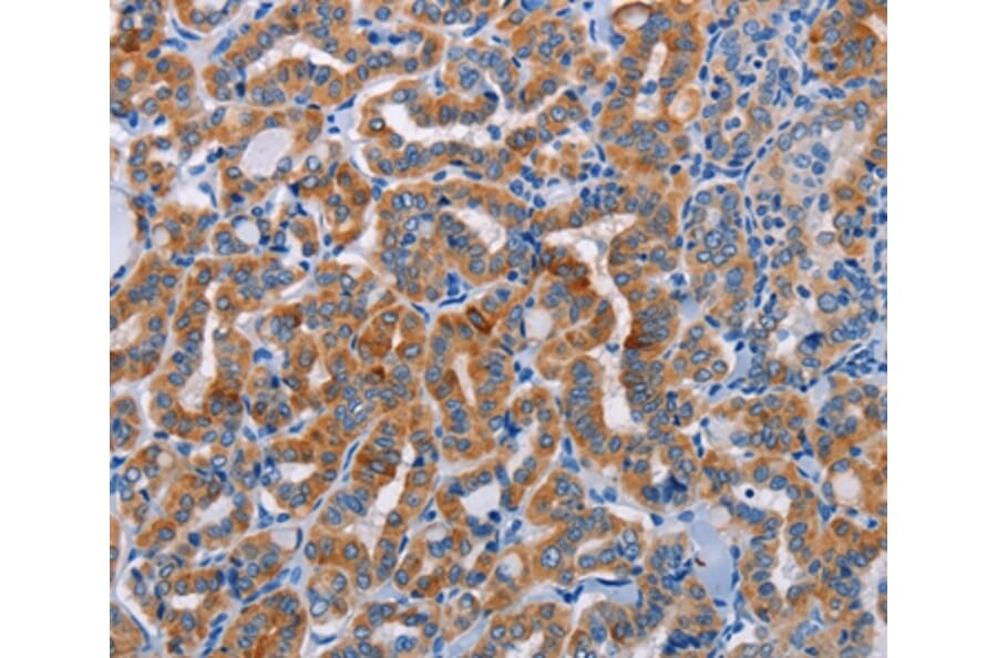 Immunohistochemistry - ALG12 Antibody from Signalway Antibody (36079) - Antibodies.com