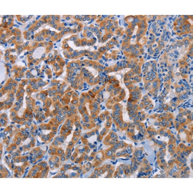 Immunohistochemistry - ALG12 Antibody from Signalway Antibody (36079) - Antibodies.com