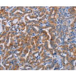 Immunohistochemistry - ALG12 Antibody from Signalway Antibody (36079) - Antibodies.com