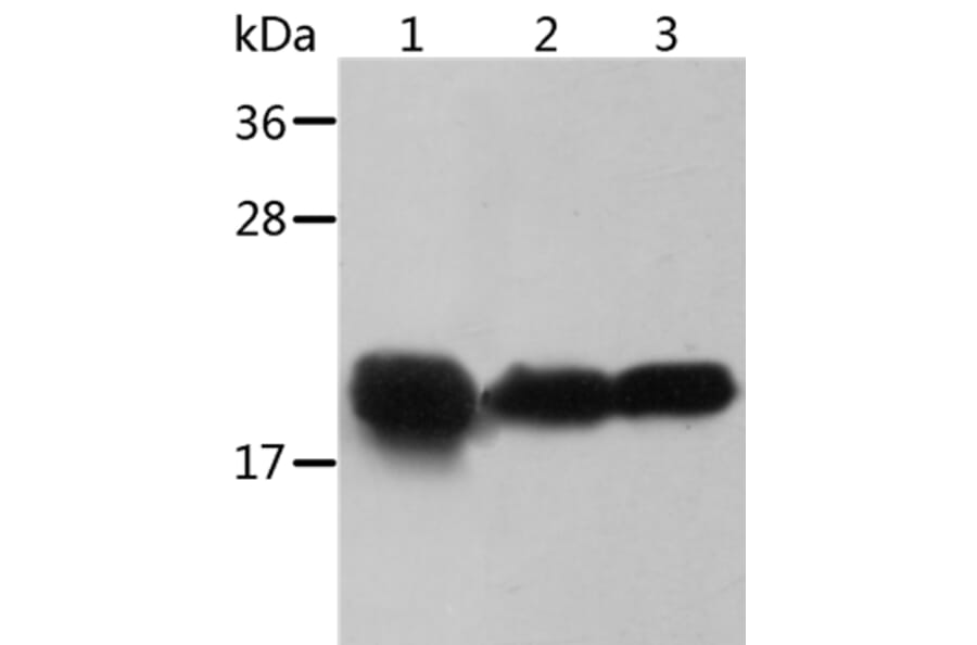 CRYAB Antibody from Signalway Antibody (36084) - Antibodies.com