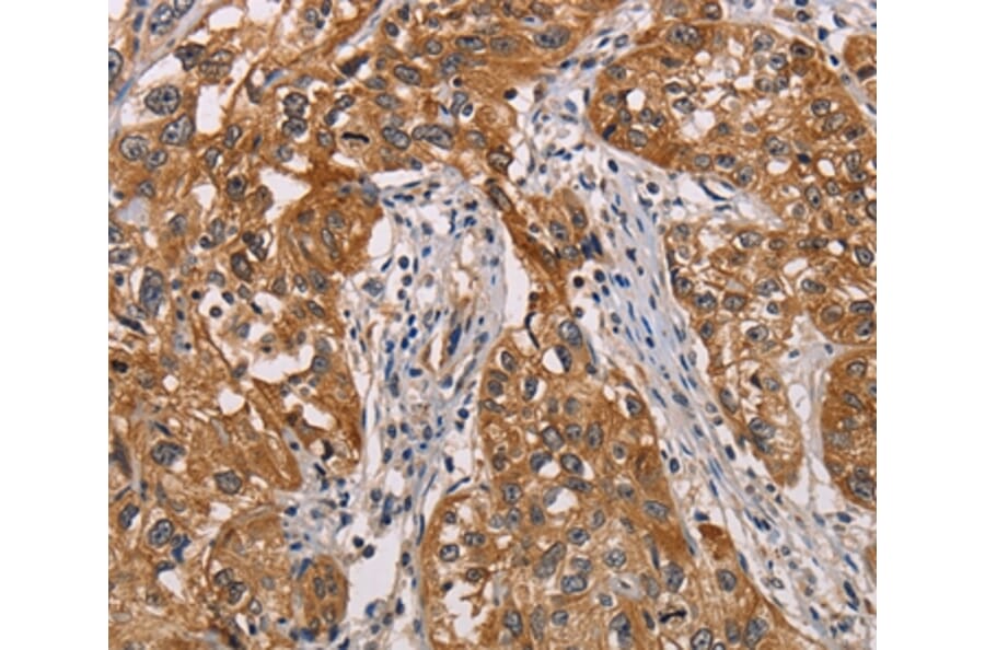 Immunohistochemistry - CRYAB Antibody from Signalway Antibody (36084) - Antibodies.com