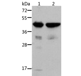 ACTA1 Antibody from Signalway Antibody (36085) - Antibodies.com