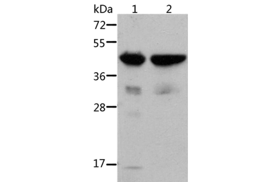 ACTA1 Antibody from Signalway Antibody (36085) - Antibodies.com