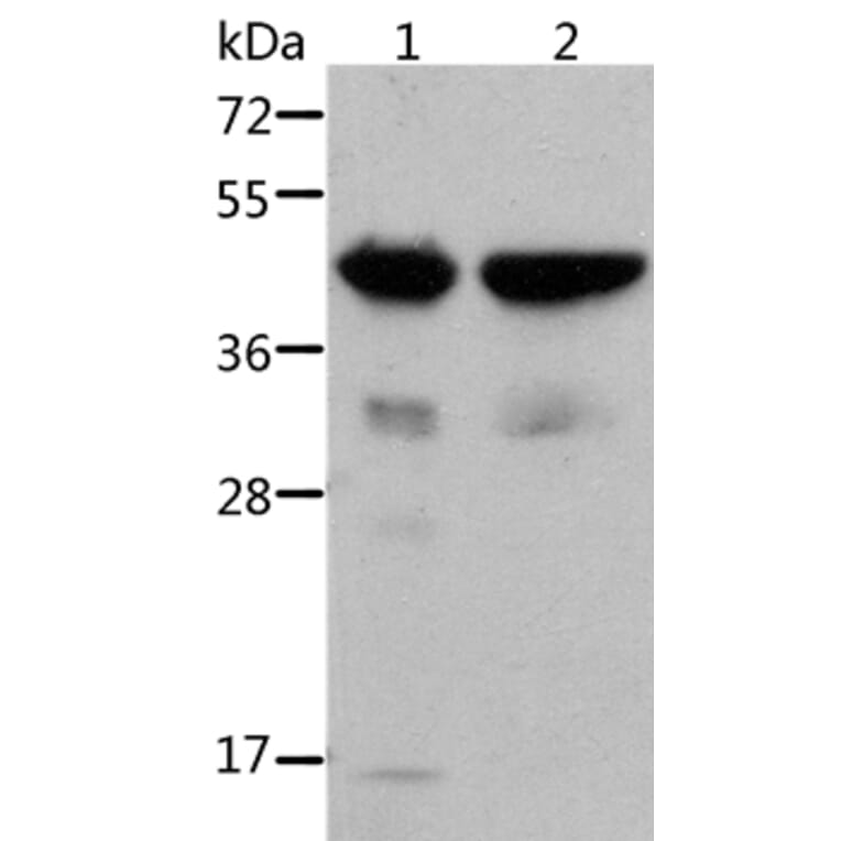 ACTA1 Antibody from Signalway Antibody (36085) - Antibodies.com