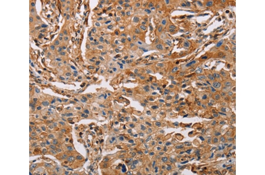 Immunohistochemistry - ACTA1 Antibody from Signalway Antibody (36085) - Antibodies.com