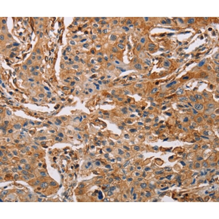 Immunohistochemistry - ACTA1 Antibody from Signalway Antibody (36085) - Antibodies.com