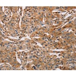 Immunohistochemistry - ACTA1 Antibody from Signalway Antibody (36085) - Antibodies.com