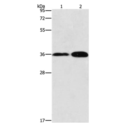 ANXA9 Antibody from Signalway Antibody (36108) - Antibodies.com