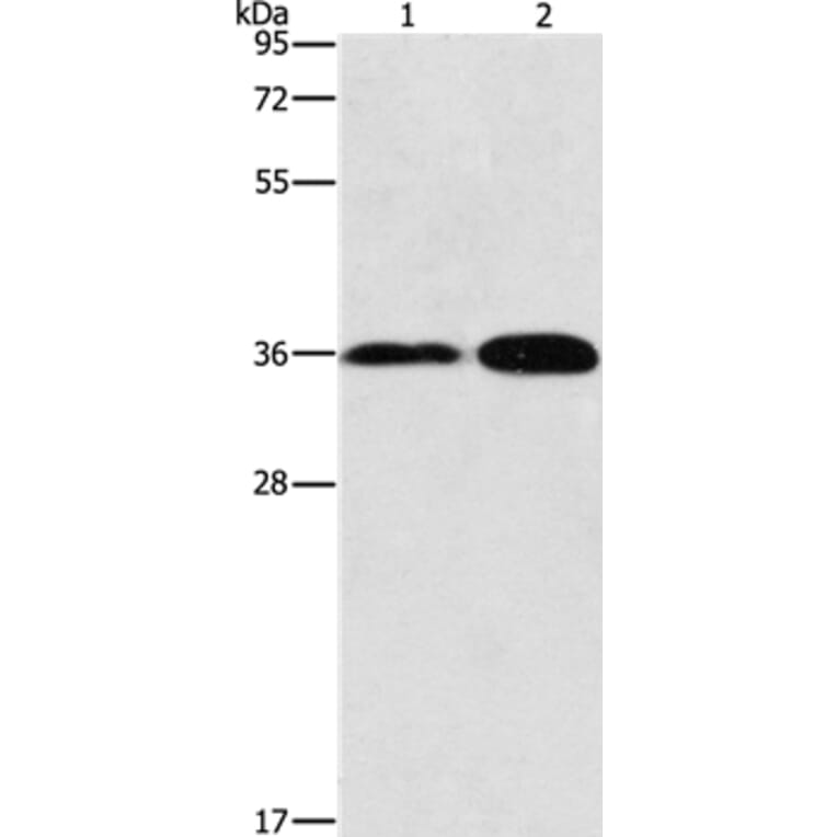 ANXA9 Antibody from Signalway Antibody (36108) - Antibodies.com