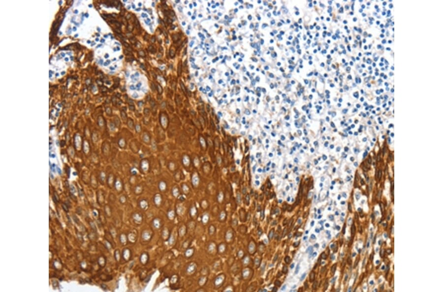 Immunohistochemistry - ANXA9 Antibody from Signalway Antibody (36108) - Antibodies.com