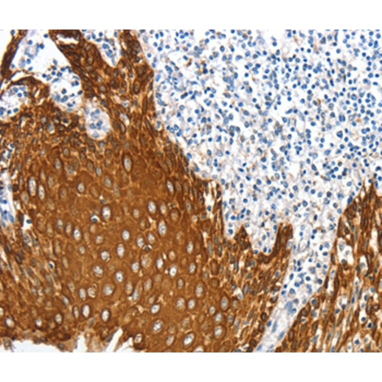Immunohistochemistry - ANXA9 Antibody from Signalway Antibody (36108) - Antibodies.com