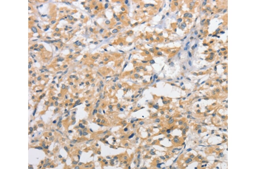 Immunohistochemistry - ATG10 Antibody from Signalway Antibody (36115) - Antibodies.com