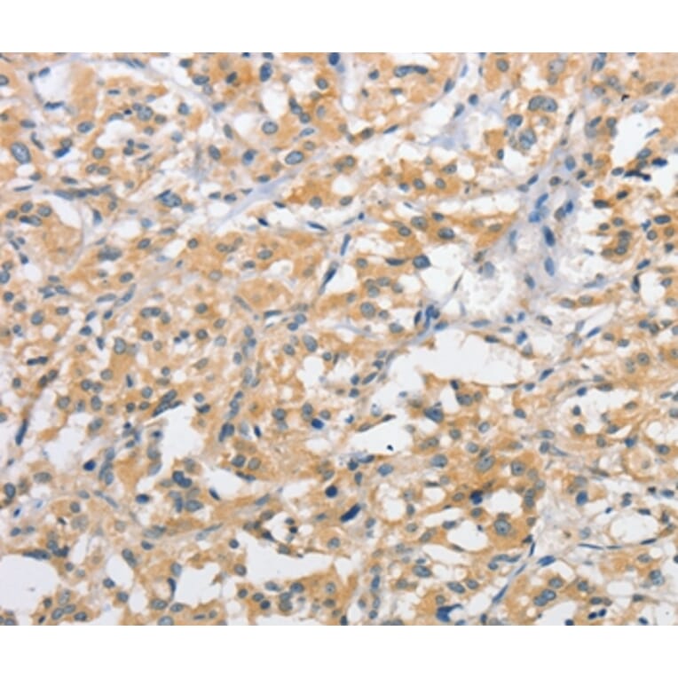 Immunohistochemistry - ATG10 Antibody from Signalway Antibody (36115) - Antibodies.com
