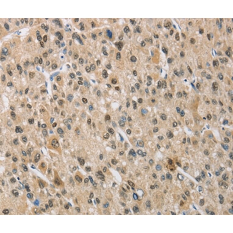 Immunohistochemistry - NAPSA Antibody from Signalway Antibody (36123) - Antibodies.com