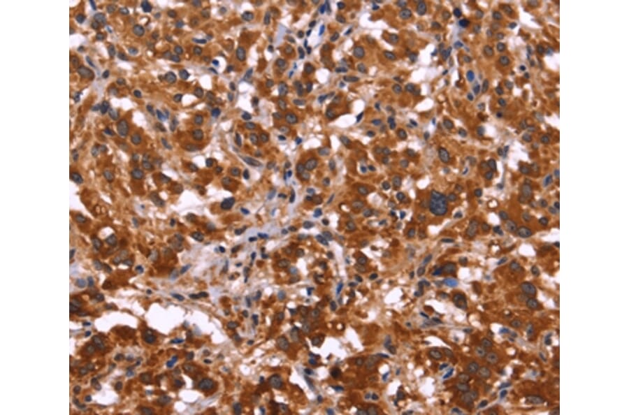 Immunohistochemistry - ARL4A Antibody from Signalway Antibody (36137) - Antibodies.com