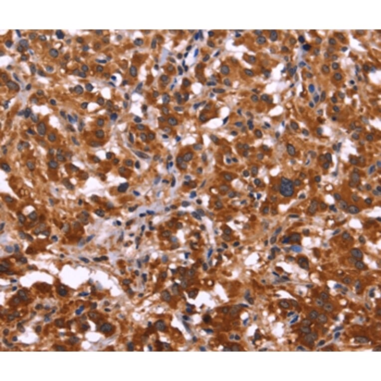 Immunohistochemistry - ARL4A Antibody from Signalway Antibody (36137) - Antibodies.com