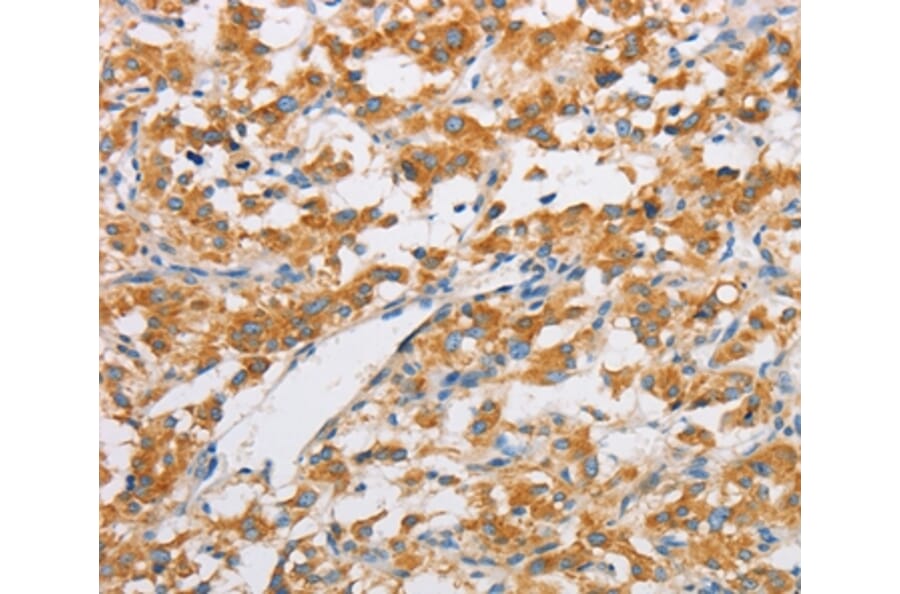 Immunohistochemistry - FARSB Antibody from Signalway Antibody (36152) - Antibodies.com
