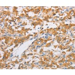 Immunohistochemistry - FARSB Antibody from Signalway Antibody (36152) - Antibodies.com