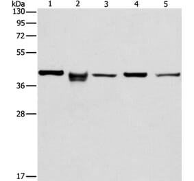 IDH3B Antibody from Signalway Antibody (36157) - Antibodies.com