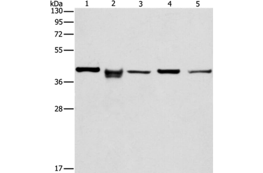 IDH3B Antibody from Signalway Antibody (36157) - Antibodies.com