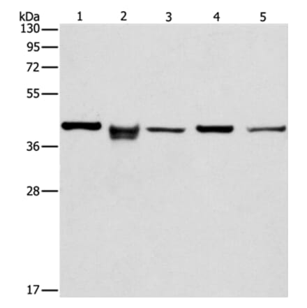 IDH3B Antibody from Signalway Antibody (36157) - Antibodies.com