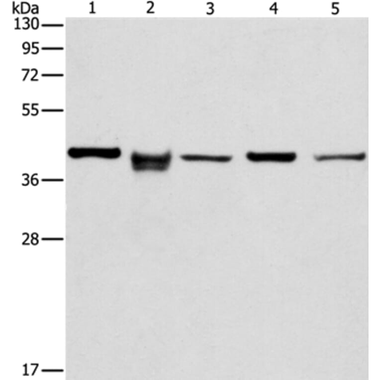 IDH3B Antibody from Signalway Antibody (36157) - Antibodies.com