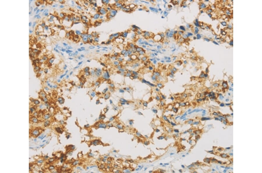 Immunohistochemistry - IDH3B Antibody from Signalway Antibody (36157) - Antibodies.com