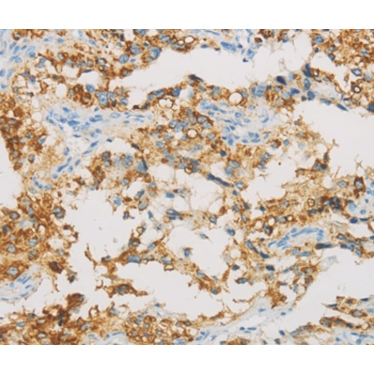 Immunohistochemistry - IDH3B Antibody from Signalway Antibody (36157) - Antibodies.com